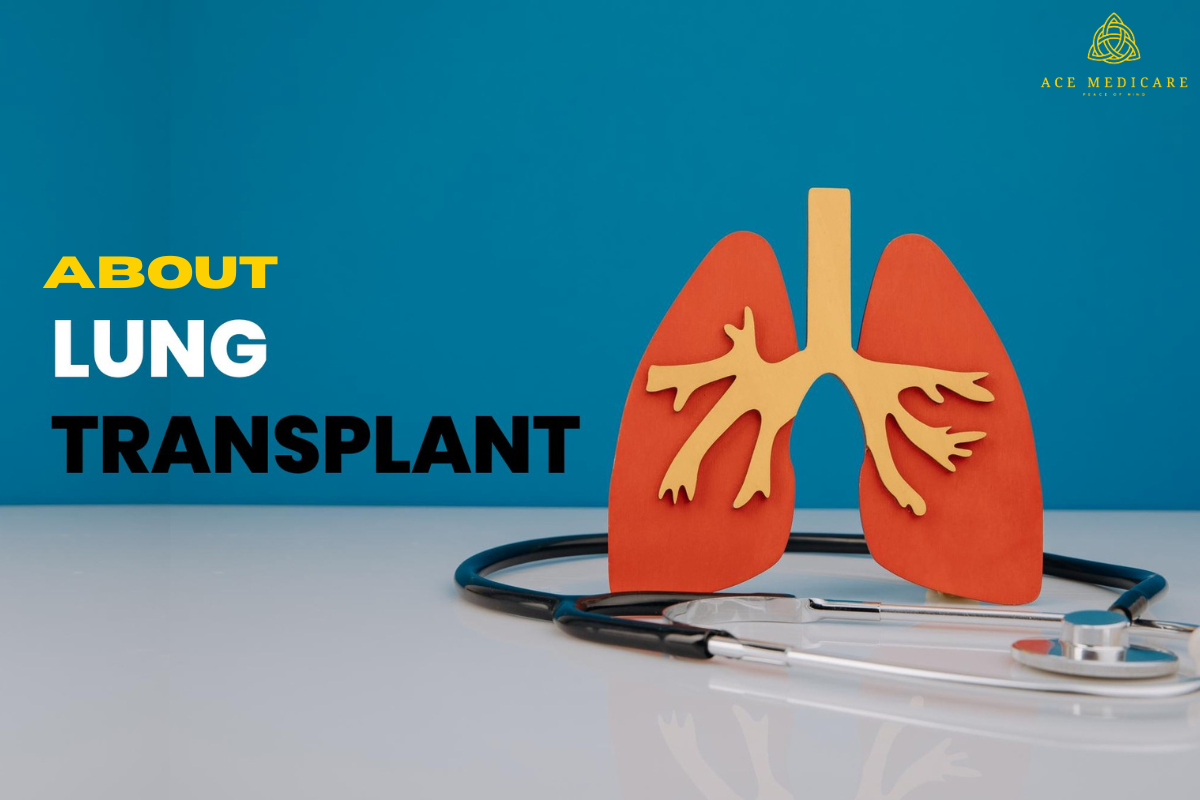 Everything You Need to Know About a Lung Transplants